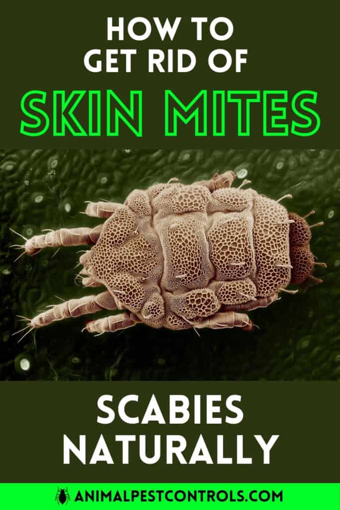 How To Get Rid of Skin Mites scabies Naturally